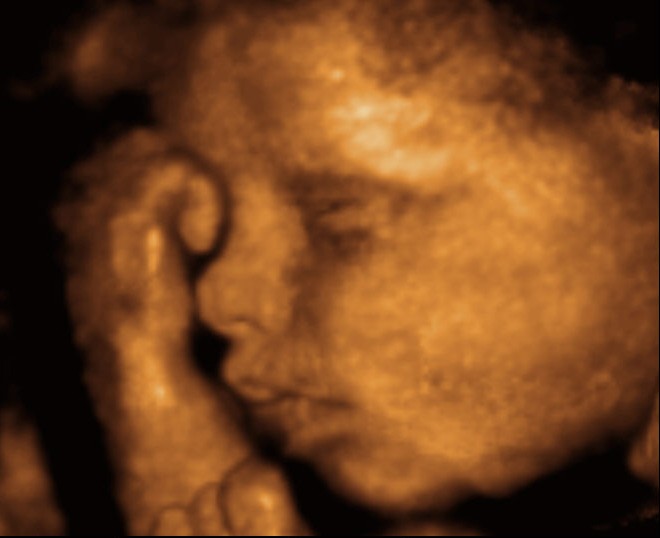 We provide high quality diagnostic ultrasounds in our facility. We provide high quality diagnostic ultrasounds in our facility.